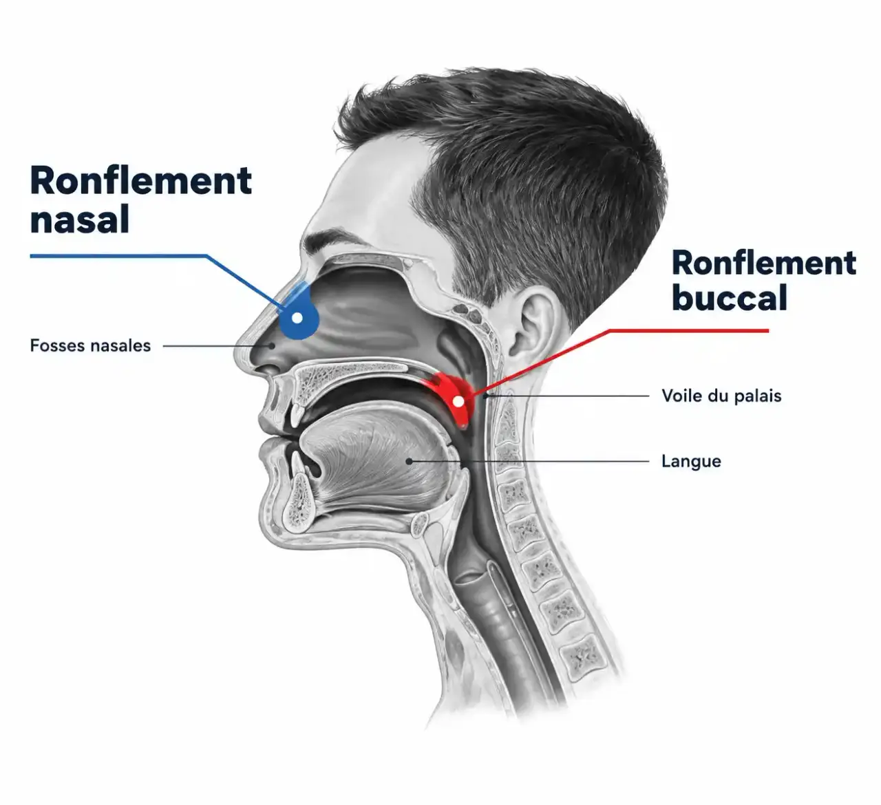 Schéma de l'origine du ronflement, nasal ou buccal, pour choisir un anti-ronflement en parapharmacie